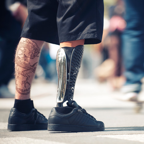3d printed prothesis